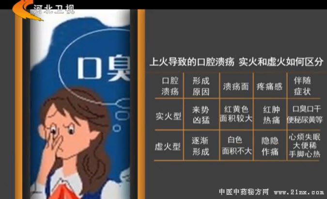 吴大真介绍如何分辨口腔溃疡的良恶性:家政女皇20161208