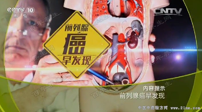 前列腺癌早发现