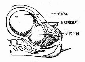 软产道图片